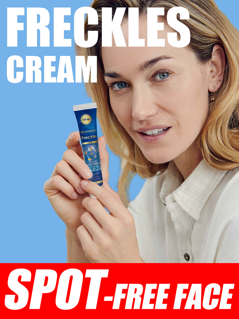 Krim Penghilang Bintik Hitam u - Luxury Skincare Cream ulasan dan harga